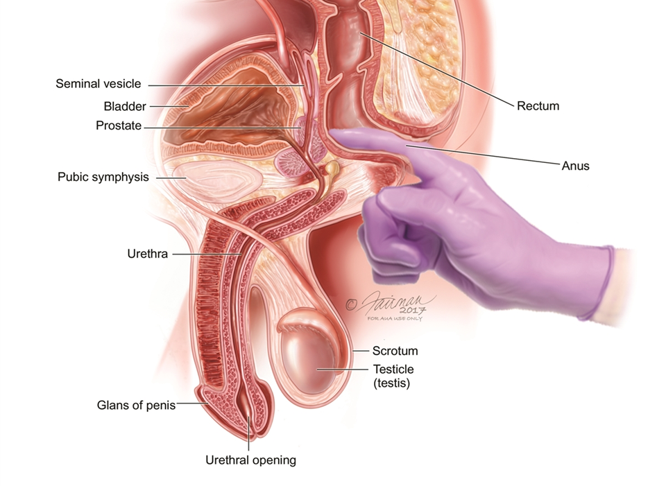 What Is a Prostate Massage?